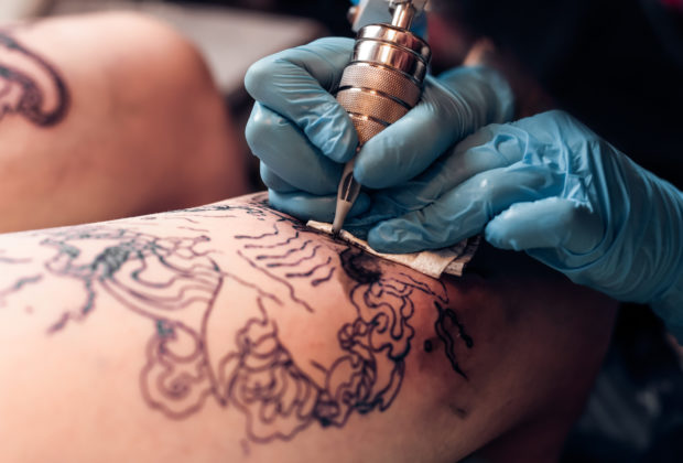 tattoo removal London